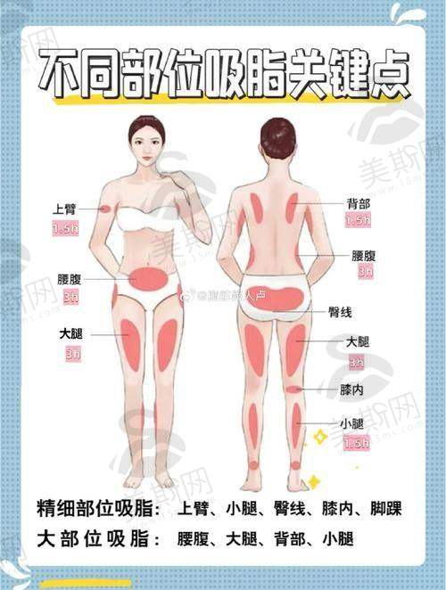 四、终极建议：什么样的人适合兰斯背部吸脂？30秒自测