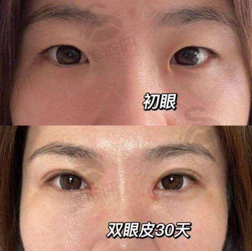 杨伟杰医生擅长项目