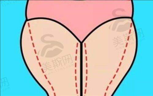 范丹医生口碑评价及真实实例