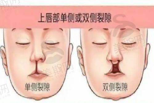 3. 现场预约