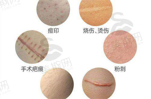 阴茎入珠多少钱医院：术前必问的5个价格相关问题