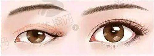 总结