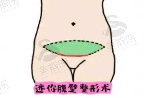 万友望医生预约挂号方式