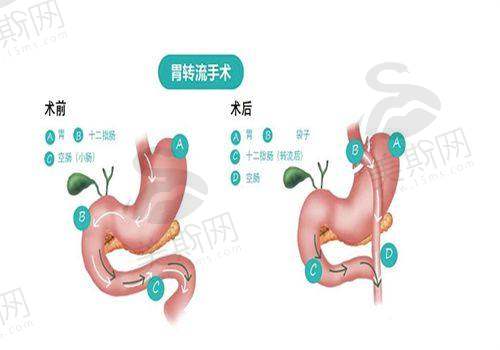 实例三:网红修复鼻摆脱“阿凡达”困扰