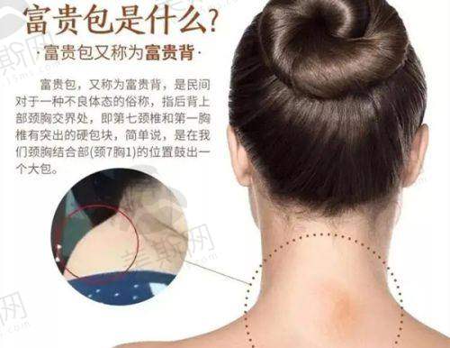 玻色因:50岁敏感肌的“温和抗老主力”,它的核心优势在哪里?