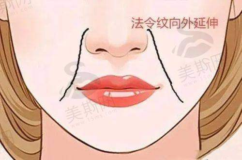 张小芸医生技术水平高