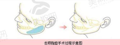 八、罗延平医生预约挂号方式
