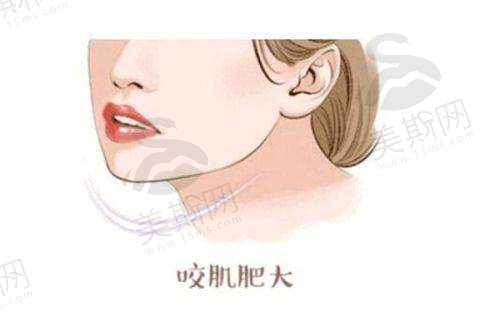 阴茎入珠多少钱医院：材质差异决定基础定价