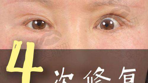 黄敬夏医生擅长项目