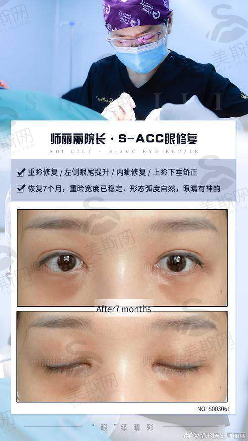 方式3:电话预约
