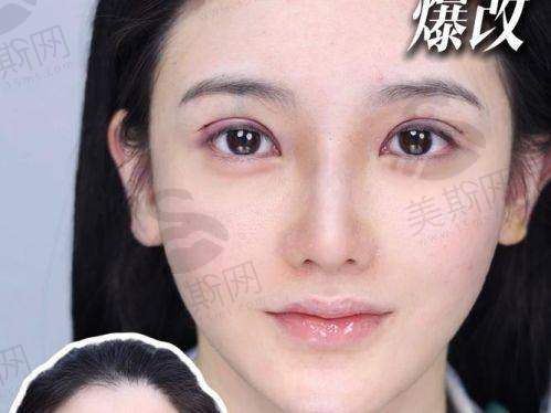 眼部整形与修复领域