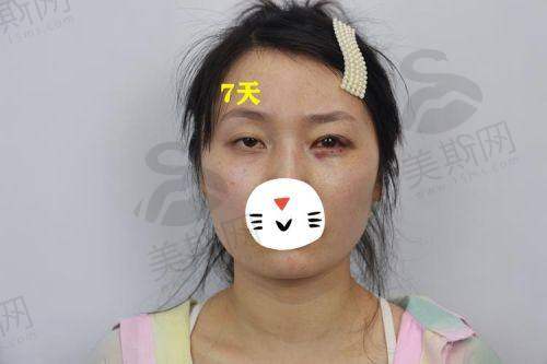 赵成利医生口碑评价及反馈实例