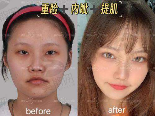 巫国辉坐诊医院:广州广大整形医院