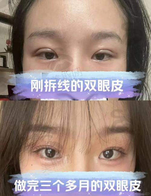 刘兵医生技术水平高