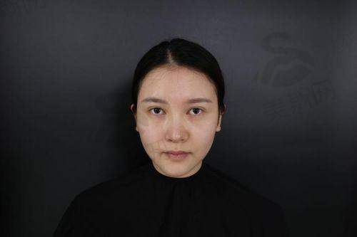 欧阳春医生预约挂号方式