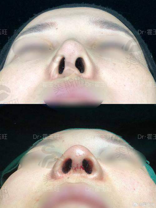 医院信息