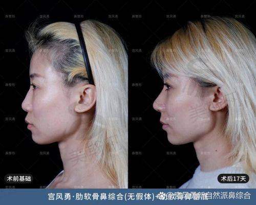 杨伟杰医生口碑评价及反馈内容