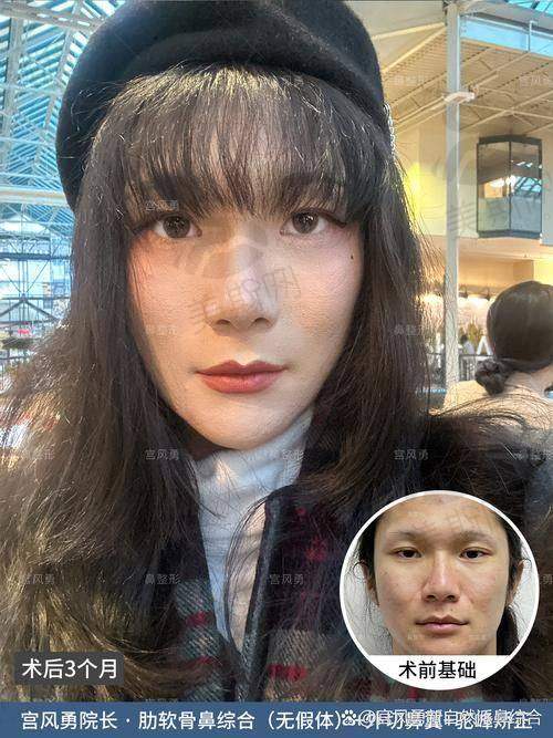 李东医生口碑评价及反馈内容