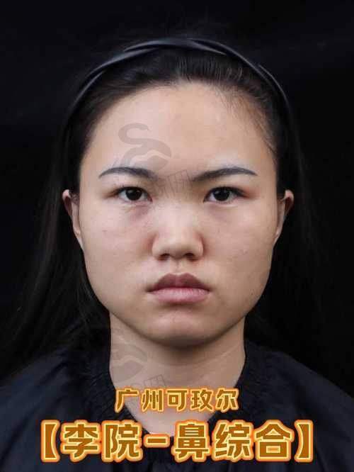 刘志刚医生擅长项目