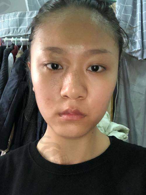3. 微创技术与并发症控制