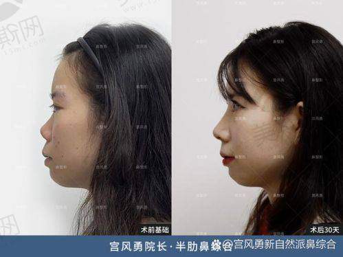 面部综合整形