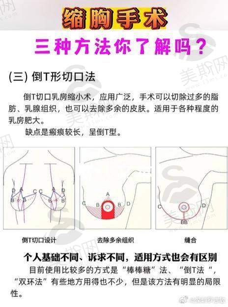 黄广香医生价格表：2025年全新收费标准