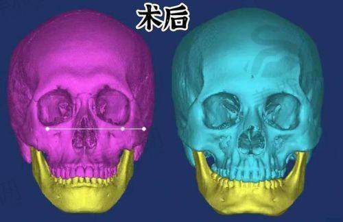 一、罗延平医生个人资料简介