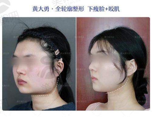 刘志刚医生价格表