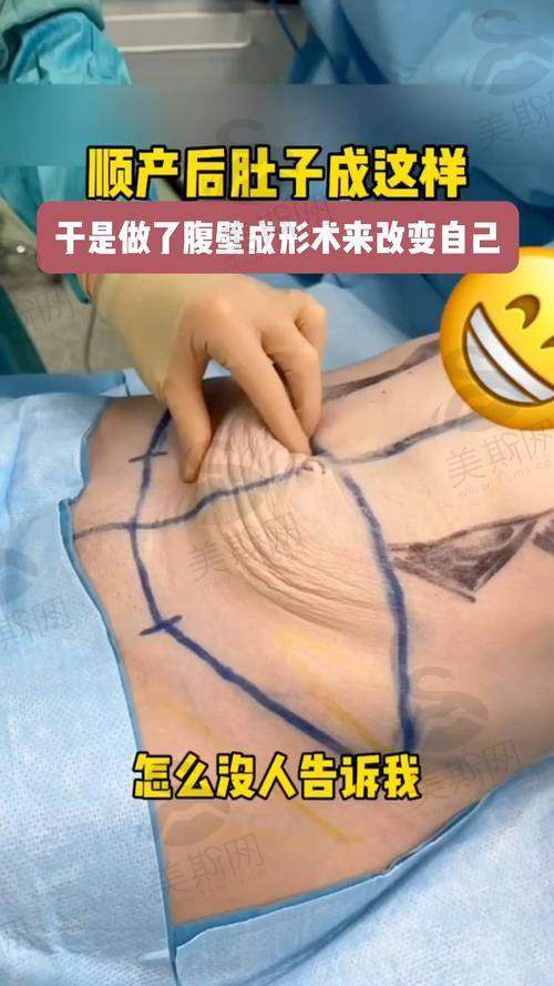 李东医生技术水平高