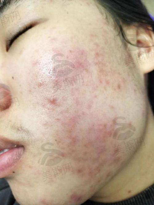 吴焱医生口碑评价及反馈内容