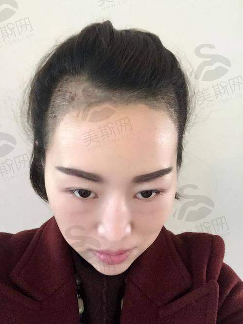 万友望医生技术水平高