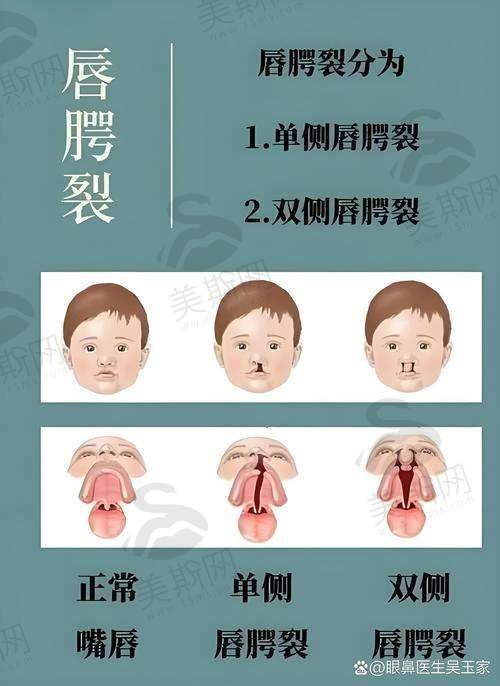 程宁新医生技术水平高