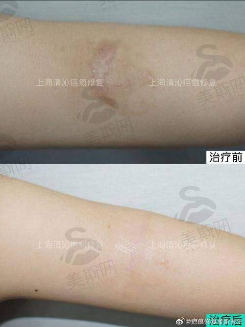 夏有辰主事医师技术水平高