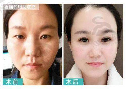 1. 个性化动态美学设计