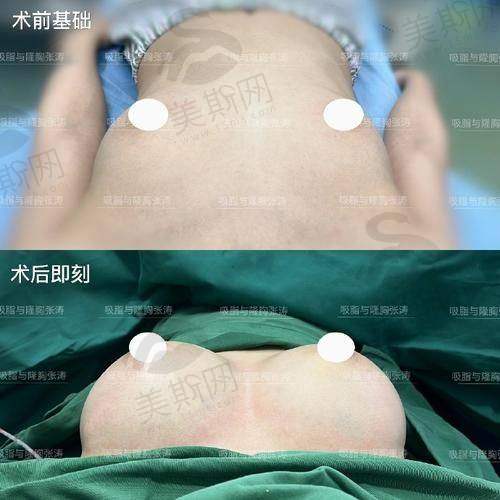 黄广香医生预约挂号：三种方式便捷预约