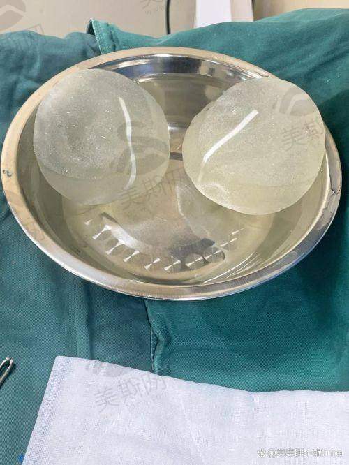 李比医生技术水平高