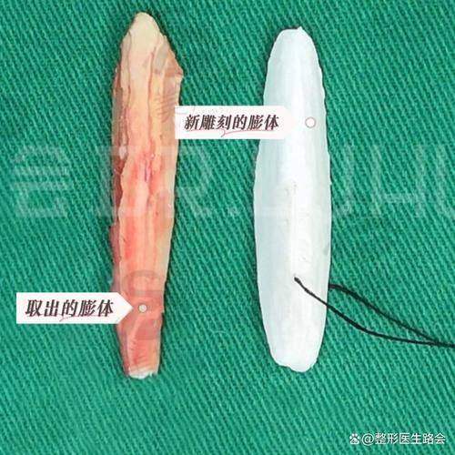 刘志刚医生预约挂号