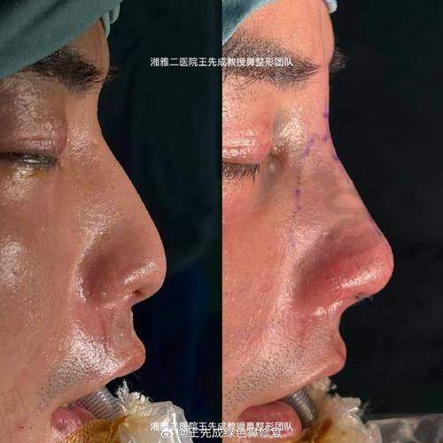 方式1:在线弹窗预约