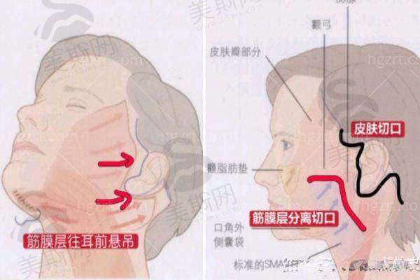 闫立新医生预约挂号攻略