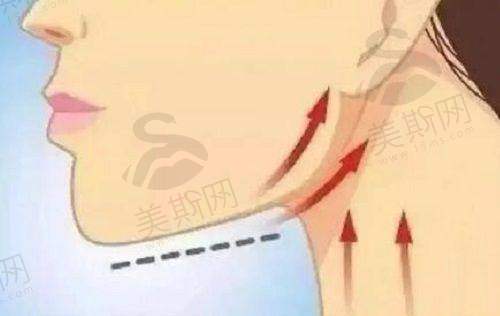 总结