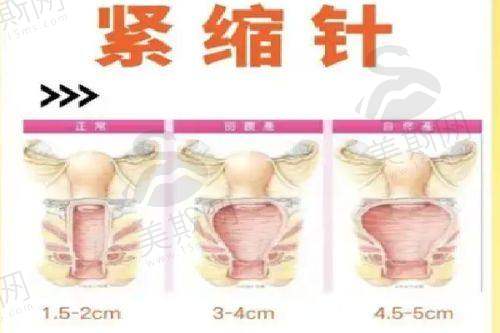 预约安可忍医生的方式