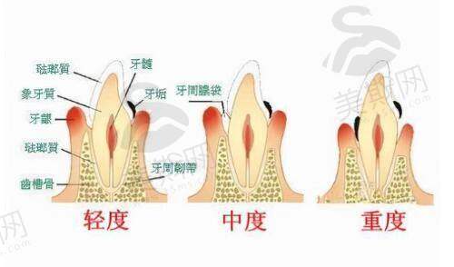 总结