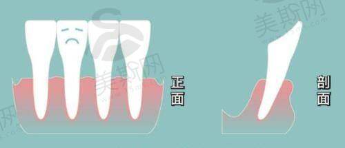 总结