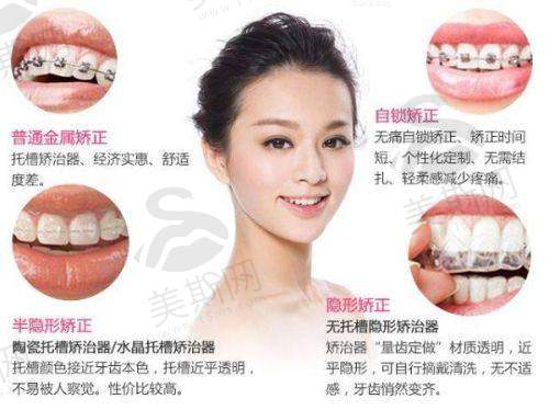 观澜附近优质牙科诊所推荐