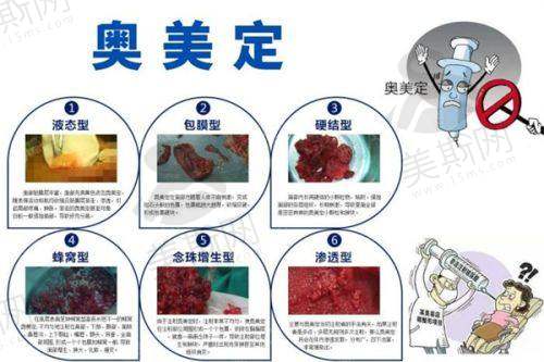 兰州皙妍丽医疗美容医院电话公开，想了解兰州皙妍丽整形怎么样、正规吗及地址看这里！