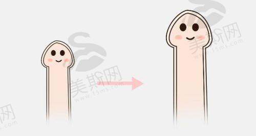 男士埋珠18颗费用明细：从基础到高端的价格差异