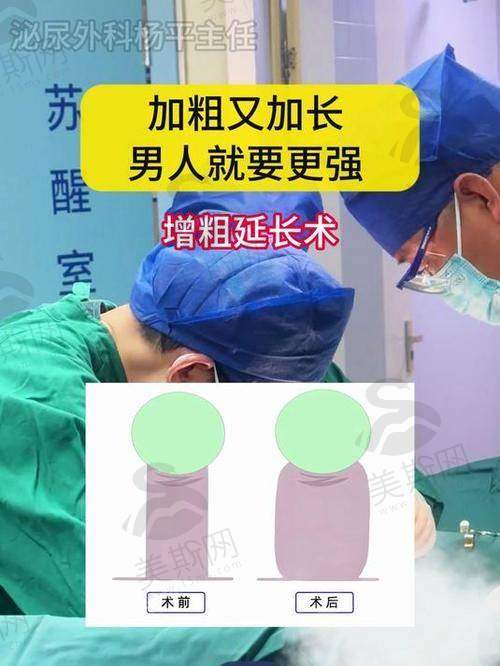 如何选择整形医院做去势手术