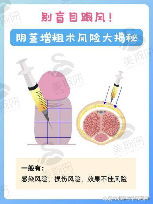 整形医院做去势手术|2025安全吗？流程及费用：国内vs泰国医院