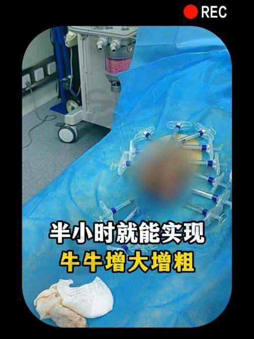 阴茎短小增粗选生物补片还是自体脂肪？