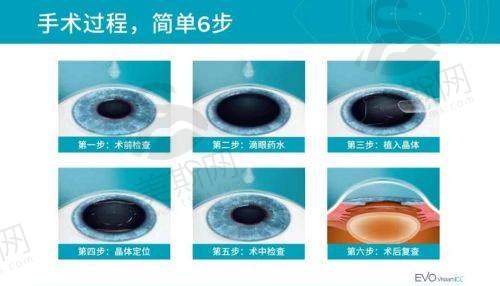 Q7：网上说